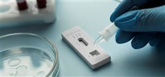 Δήμος Καλαμαριάς: Πού θα διενεργούνται rapid test