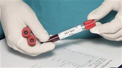 Θεσσαλονίκη: Δωρεάν εξετάσεις HIV και ηπατητίδας για μία εβδομάδα