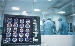 Έλληνες ερευνητές: Νέα αντικαρκινική θεραπεία με υπερήχους